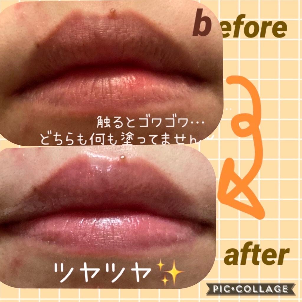 BubiBubi Lip/unpa/リップケアを使ったクチコミ(4枚目)