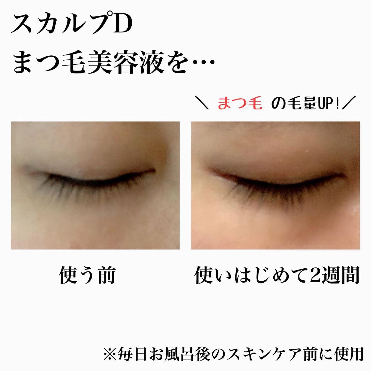 スカルプD ボーテ ピュアフリーアイラッシュセラム　プレミアム/アンファー(スカルプD)/まつげ美容液を使ったクチコミ（3枚目）