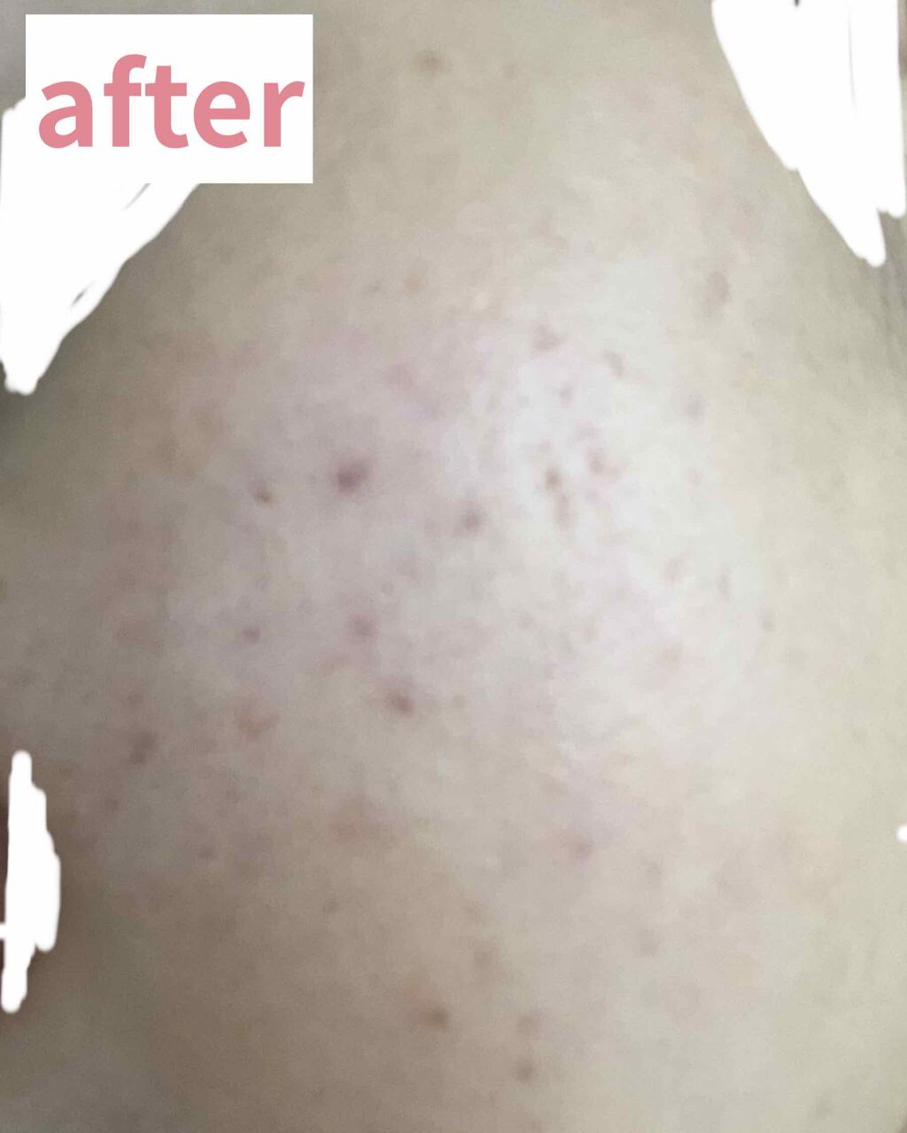 DHC マルチビタミン/DHC/美容サプリメントを使ったクチコミ(3枚目)