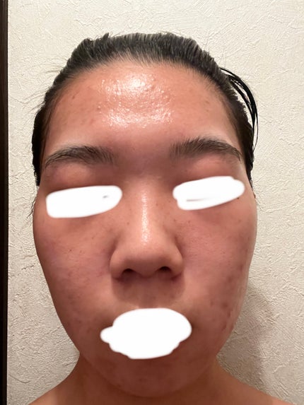 RXザ・レチノール0.1クリーム/COSRX/フェイスクリームを使ったクチコミ(1枚目)