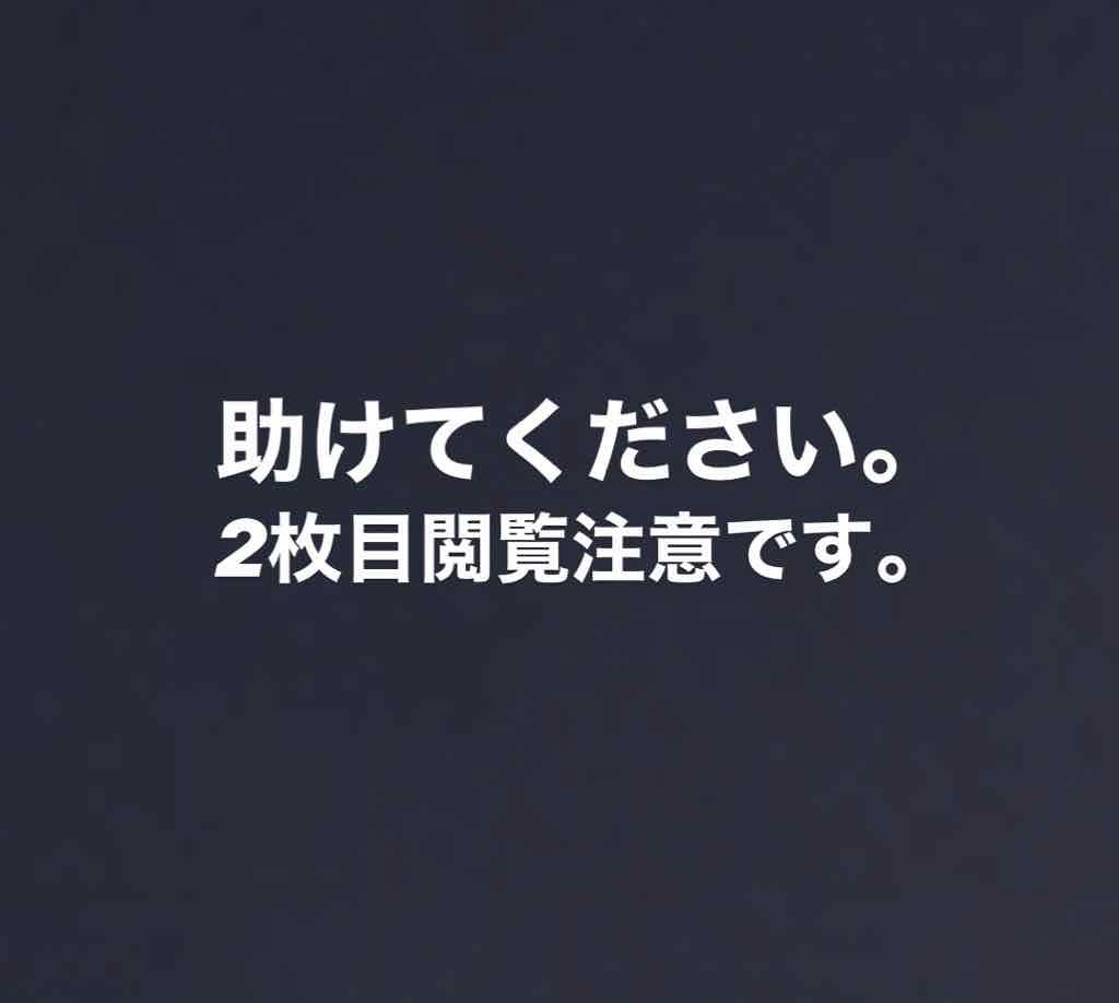 ニキビ治療薬(医薬品)/メンソレータム アクネス/その他を使ったクチコミ（1枚目）