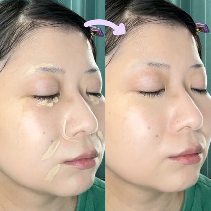 ダーマシンコンシーラー/23years old/リキッドコンシーラーを使ったクチコミ(7枚目)