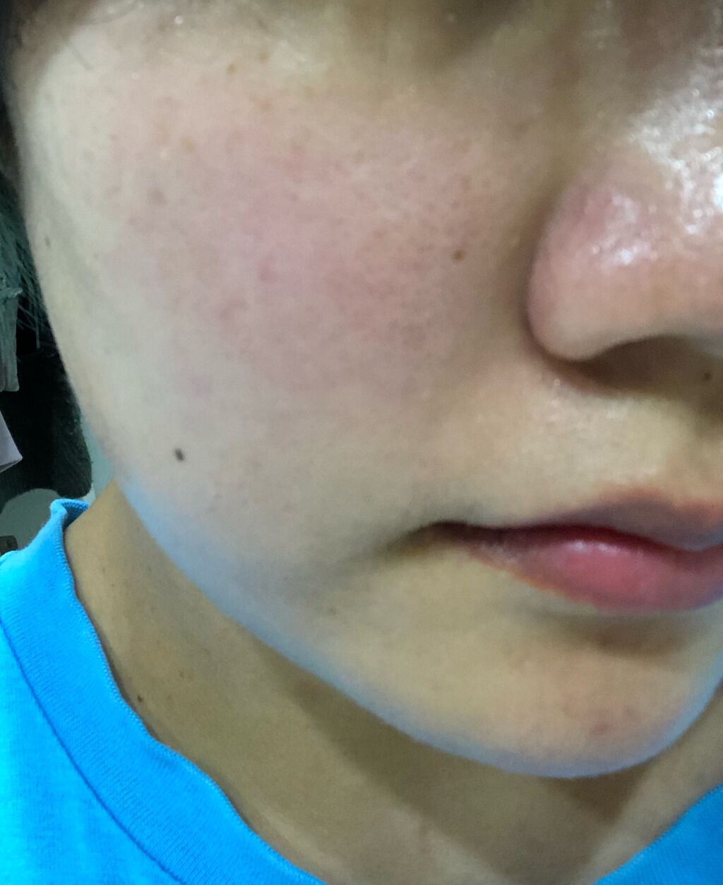 デュイセル シカプラスバーム/DEWYCEL/フェイスクリームを使ったクチコミ（3枚目）