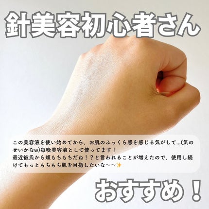 fractionalCC ニードルセラムC/fractionalCC/美容液を使ったクチコミ(4枚目)