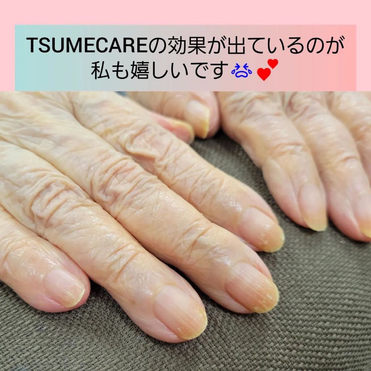 TSUMECARE/NailSalon mayunail/ネイルオイル・トリートメントを使ったクチコミ(3枚目)