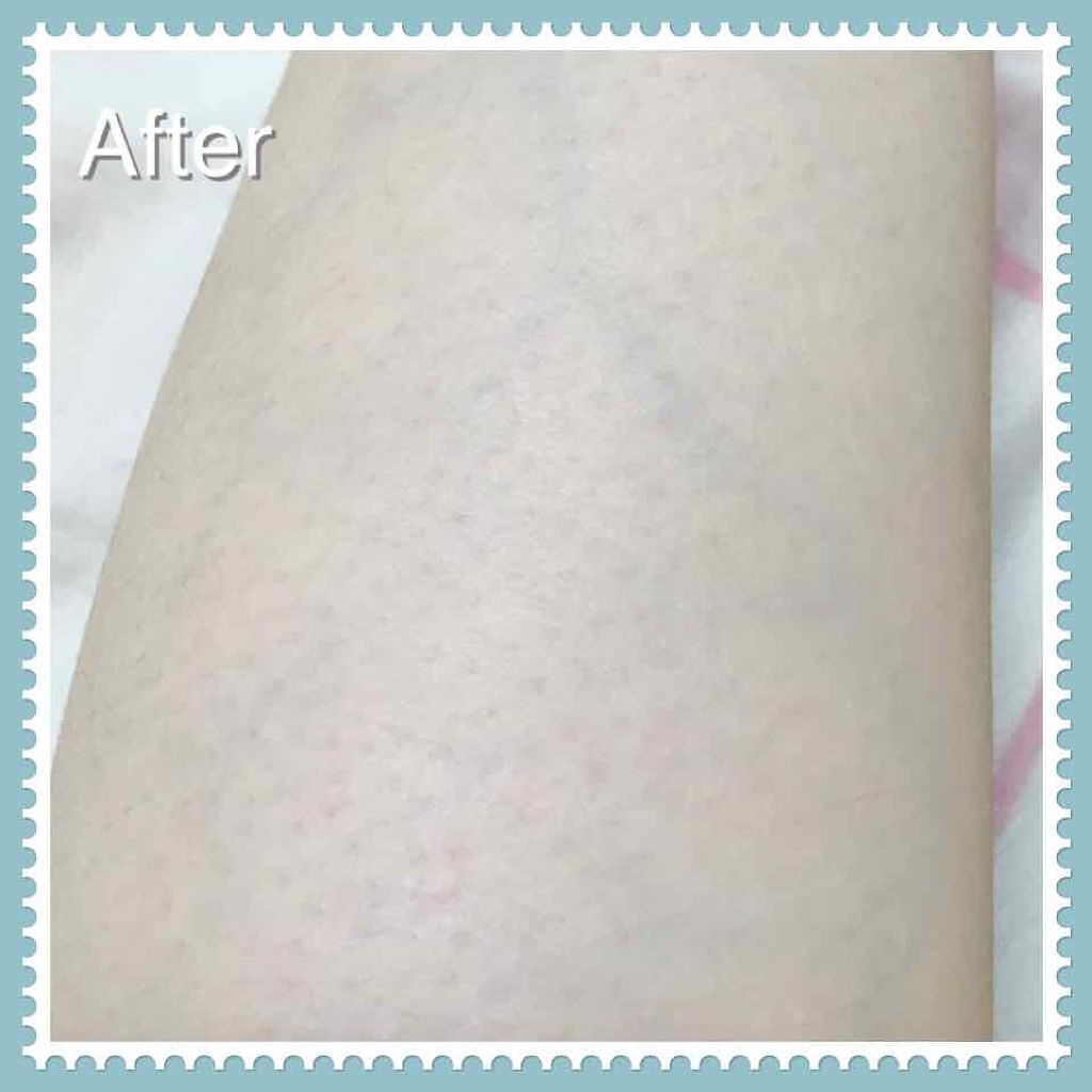 スムーズスキン/DAISO/ムダ毛ケアを使ったクチコミ（3枚目）