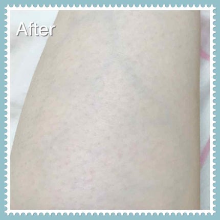 スムーズスキン/DAISO/ムダ毛ケアを使ったクチコミ(3枚目)