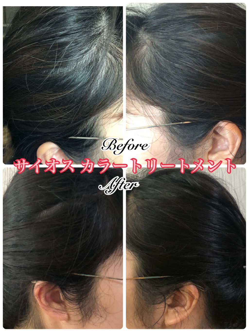 カラートリートメント/サイオス/ヘアカラーを使ったクチコミ(5枚目)