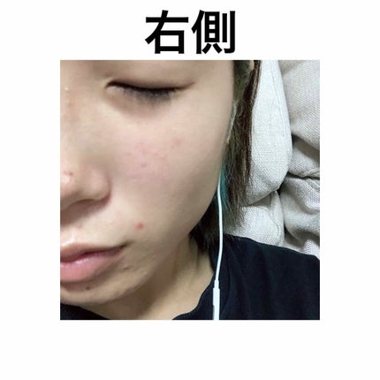 DHC ビタミンBミックス/DHC/美容サプリメントを使ったクチコミ(4枚目)