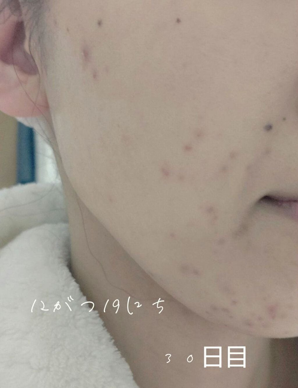 チョコラBBプラス (医薬品)/チョコラBB/その他を使ったクチコミ(4枚目)