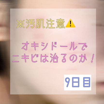 オキシドール(医薬品)/日本薬局方/その他を使ったクチコミ(1枚目)
