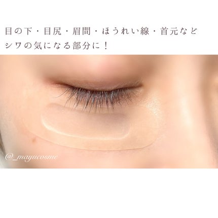 W+ マイクロ ニードル パッチ/SNP/アイケア・アイクリームを使ったクチコミ(4枚目)