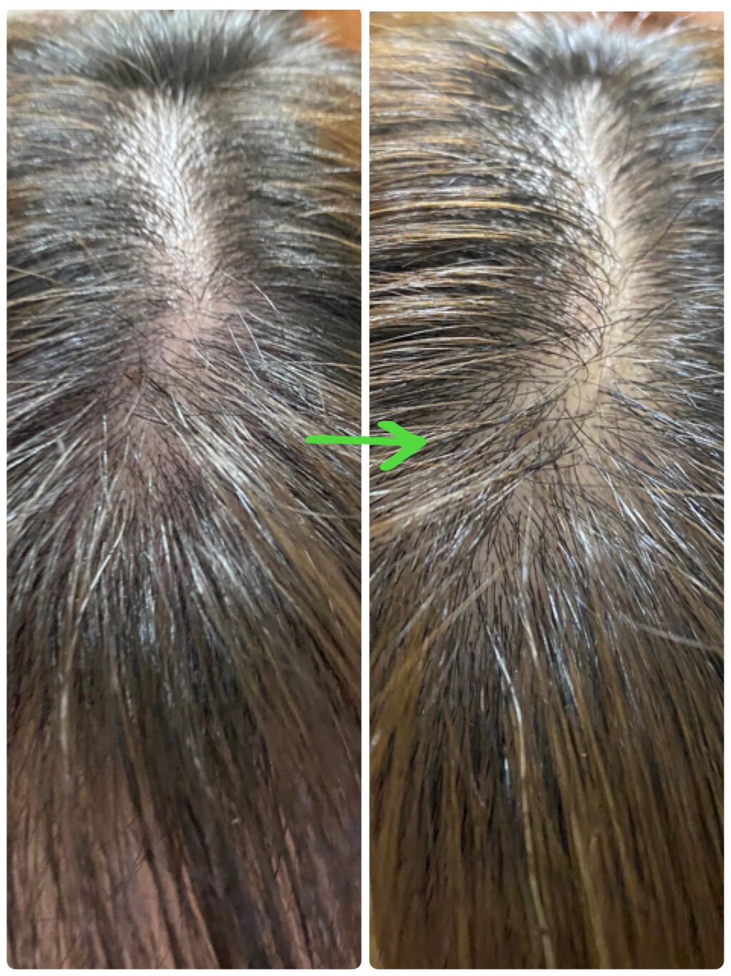 HINOKI SHAMPOO/GRAFEN /市販シャンプーを使ったクチコミ（2枚目）