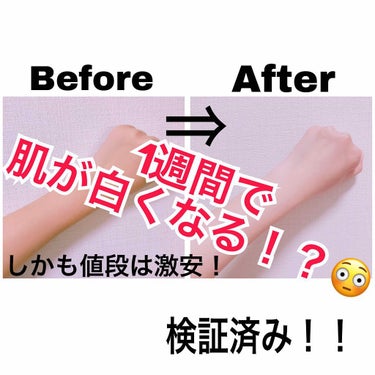 嘘じゃなかった！！本当に白くなった！！✨

_________________________________

好きな人に会う予定ができて久々に会うから可愛い姿がいい！と思ってダイエットと短期間で出来