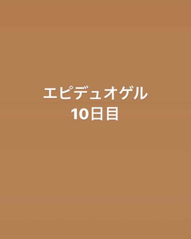 エピデュオゲル/マルホ株式会社/その他を使ったクチコミ（1枚目）