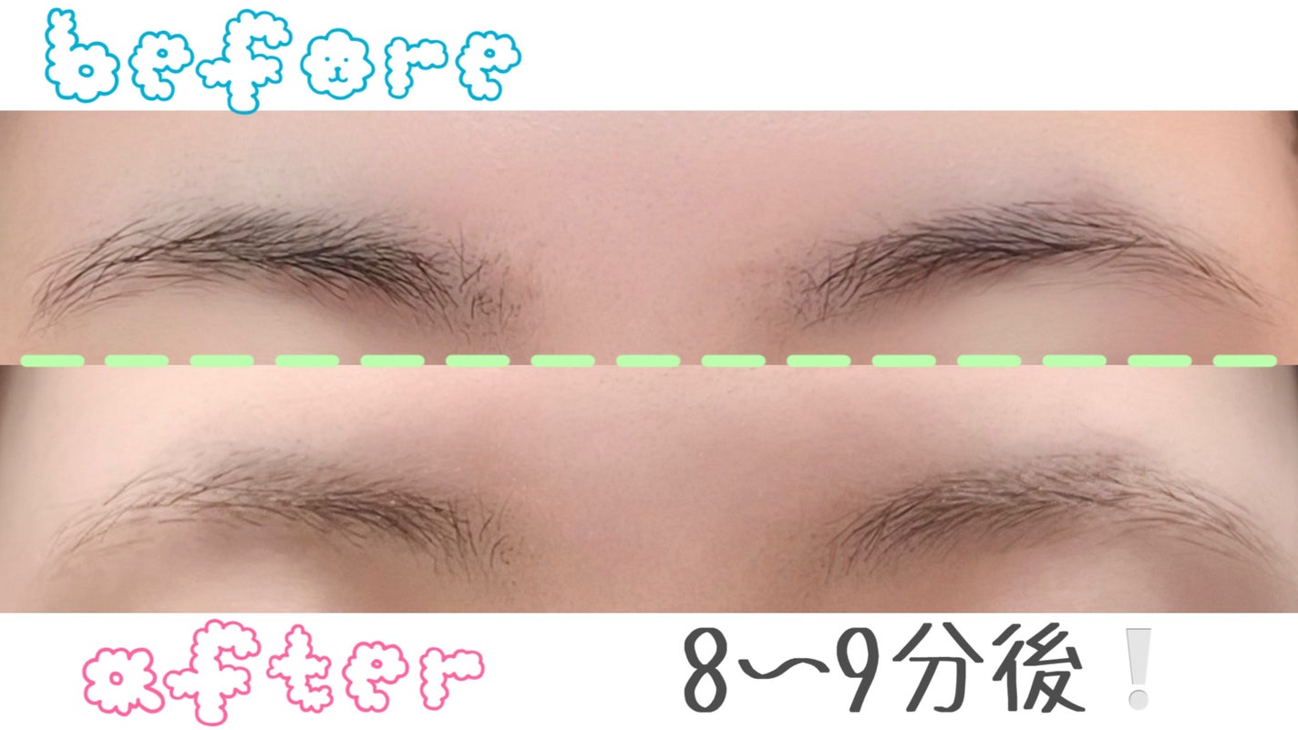 脱色クリーム 敏感肌用/エピラット/ムダ毛ケアを使ったクチコミ(2枚目)