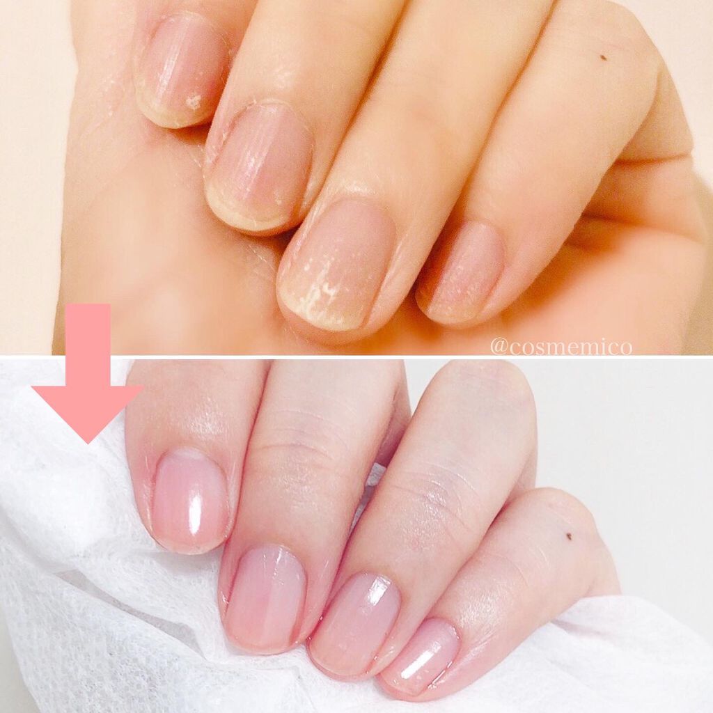 ウルンラップネイルセラム/ウルンラップ/ネイルオイル・トリートメントを使ったクチコミ（2枚目）