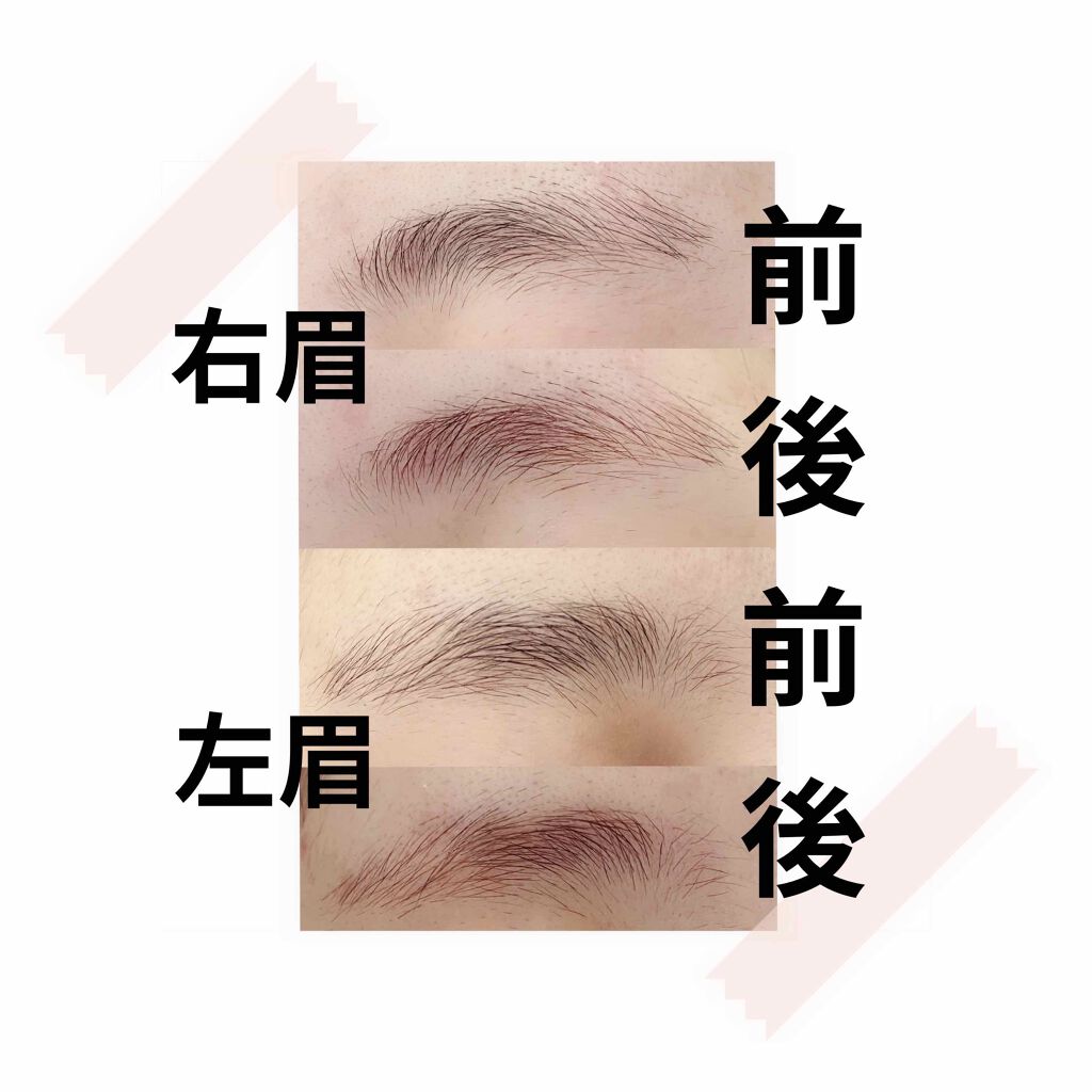 脱色クリーム スピーディー/エピラット/ムダ毛ケアを使ったクチコミ(4枚目)