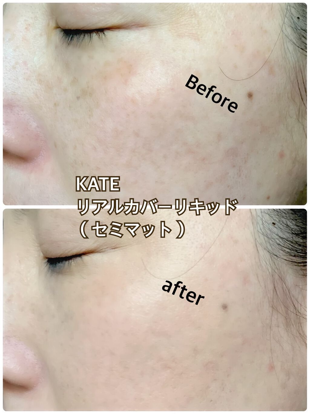リアルカバーリキッド(セミマット)/KATE/リキッドファンデーションを使ったクチコミ(6枚目)