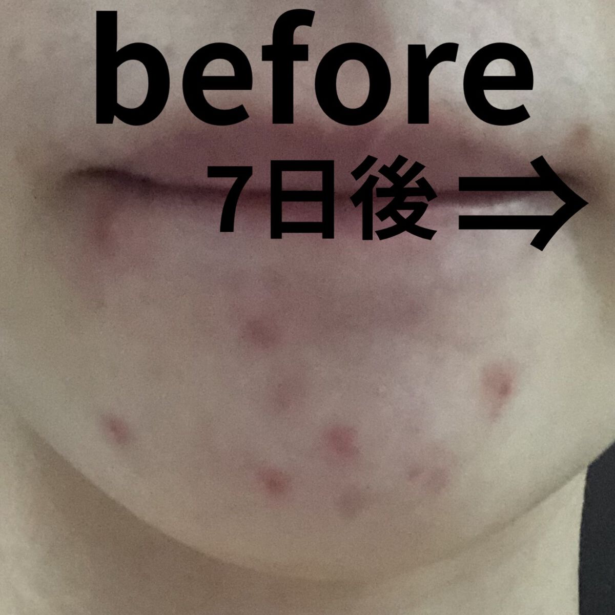 ドクダミ 77 スージングトナー/Anua/化粧水を使ったクチコミ（1枚目）