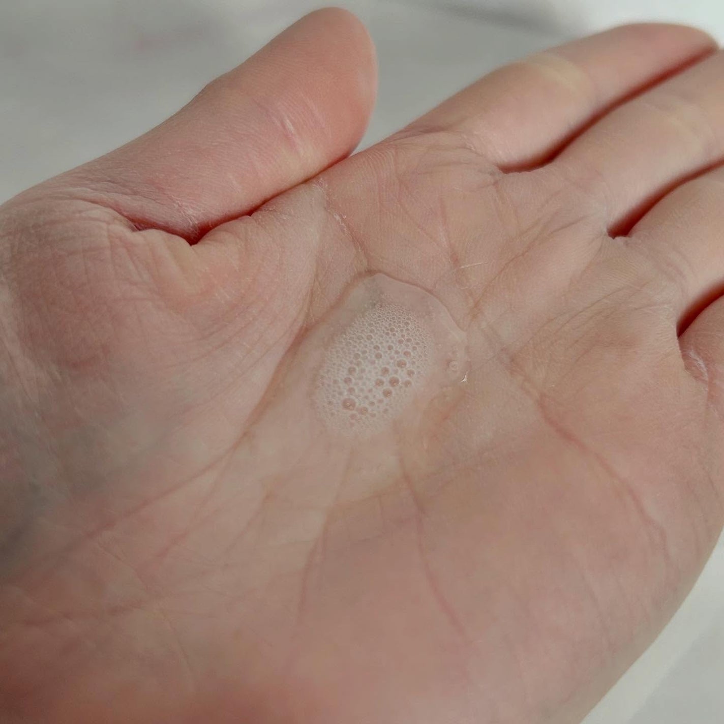 モイストケア ローション MB/d プログラム/化粧水を使ったクチコミ(2枚目)