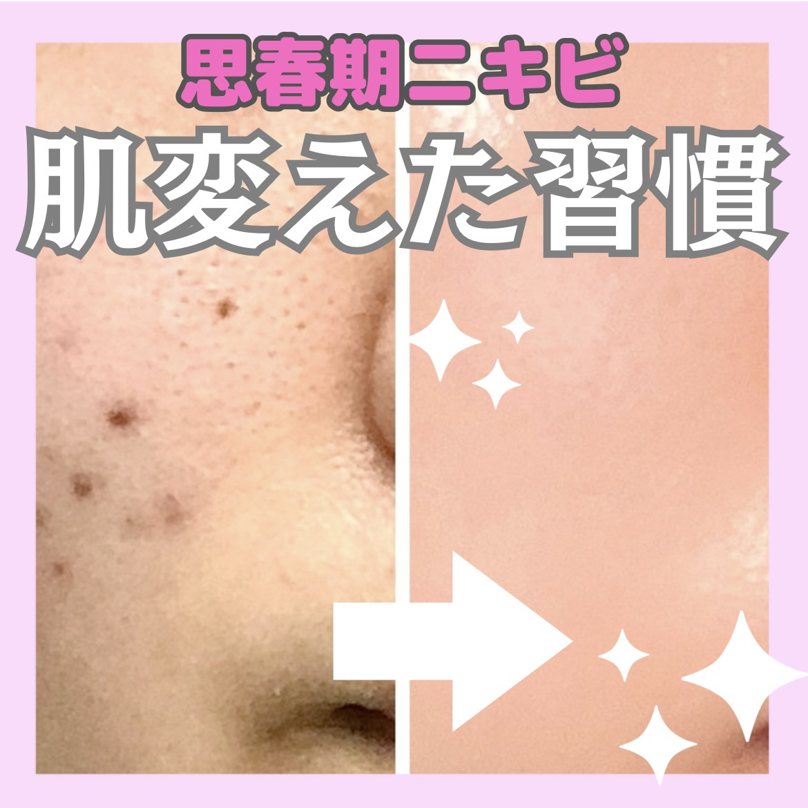 明色美顔水 薬用化粧水/美顔/化粧水を使ったクチコミ（1枚目）