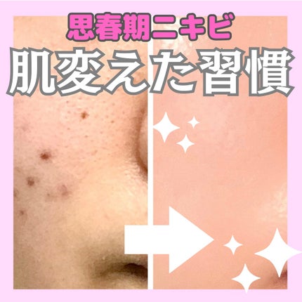 明色美顔水 薬用化粧水/美顔/化粧水を使ったクチコミ(1枚目)