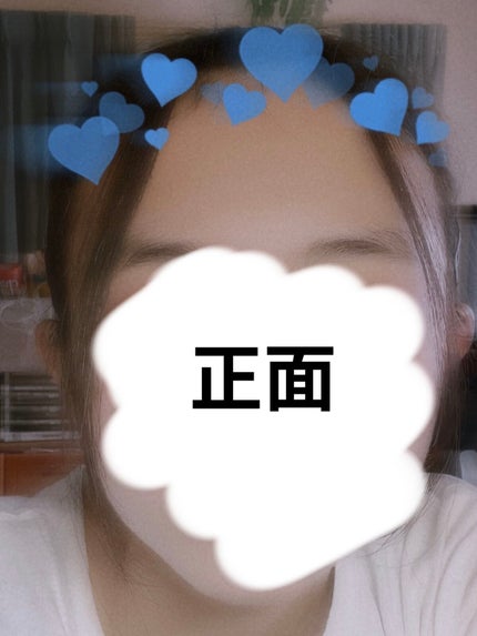 ヘアアクセルレーターEX フローラルアップルの香り/加美乃素本舗/頭皮ローションを使ったクチコミ(4枚目)