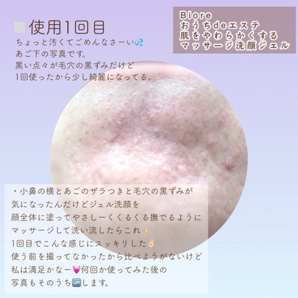 おうちdeエステ 肌をやわらかくするマッサージ洗顔ジェル 炭/ビオレ/その他洗顔料を使ったクチコミ(4枚目)