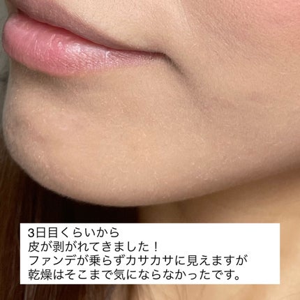 ダーマスキンピーリング/BQCELL/その他キットセットを使ったクチコミ(6枚目)