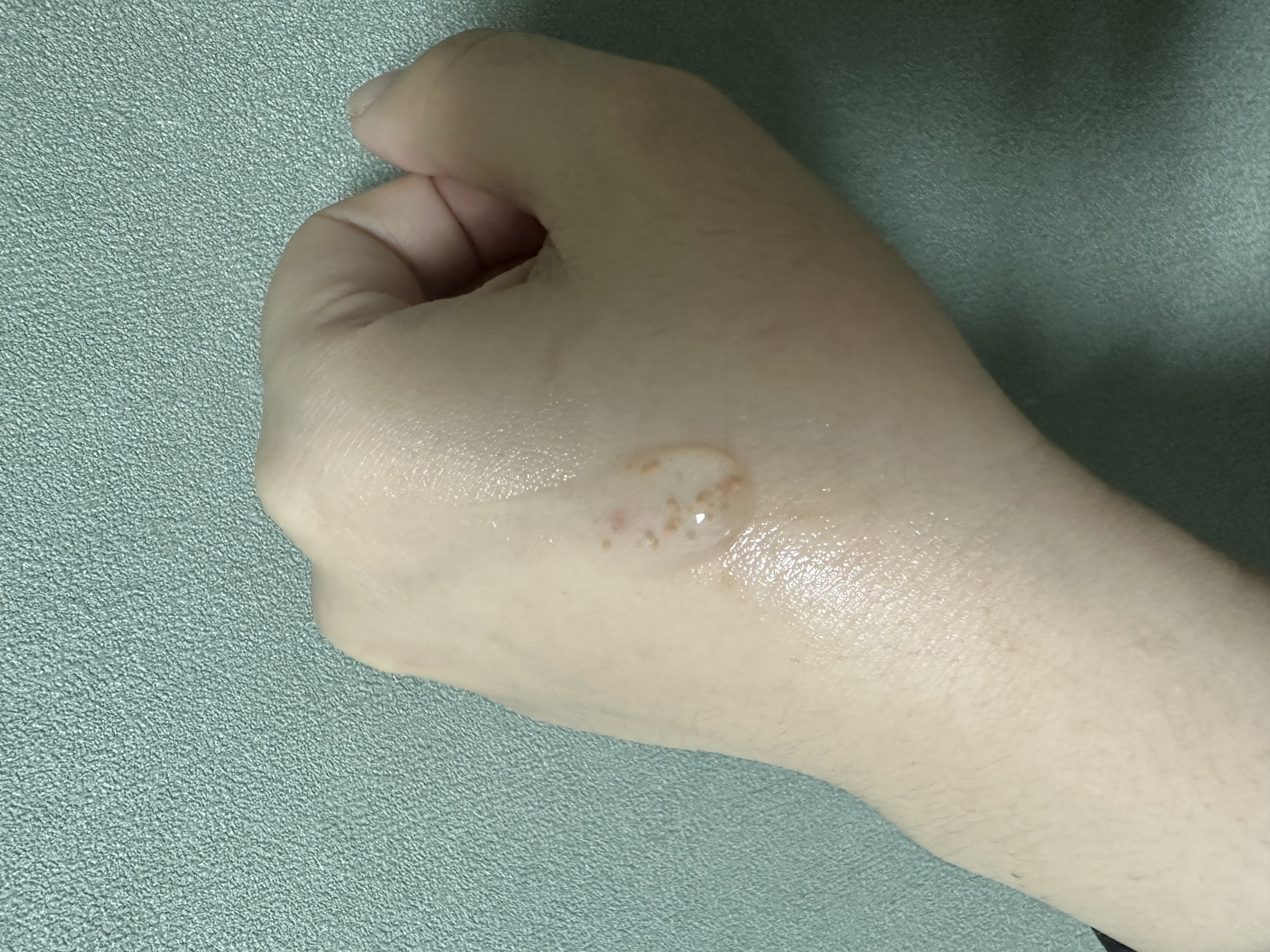 グルタチオンソームダークスポットセラムビタドロップ/Abib /美容液を使ったクチコミ（2枚目）