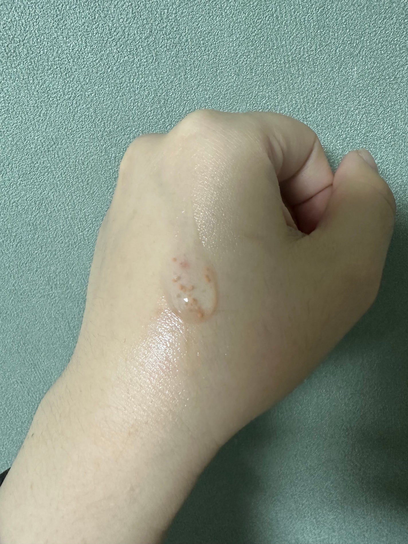 アビブ グルタチオンソームダークスポットセラムビタドロップ/Abib /美容液を使ったクチコミ(2枚目)