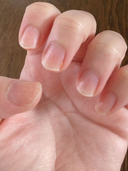 ネイルトリートメント N/ネイルネイル/ネイルオイル・トリートメントを使ったクチコミ(4枚目)