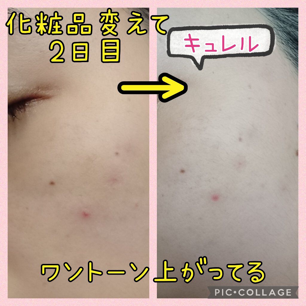 潤浸保湿 フェイスクリーム/キュレル/フェイスクリームを使ったクチコミ(1枚目)