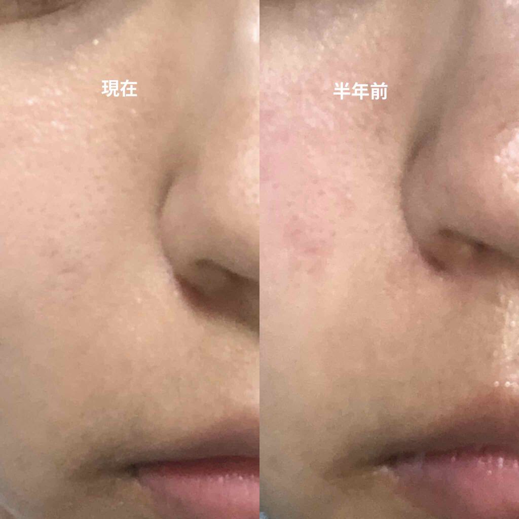 どろあわわ/健康コーポレーション/洗顔フォームを使ったクチコミ（2枚目）