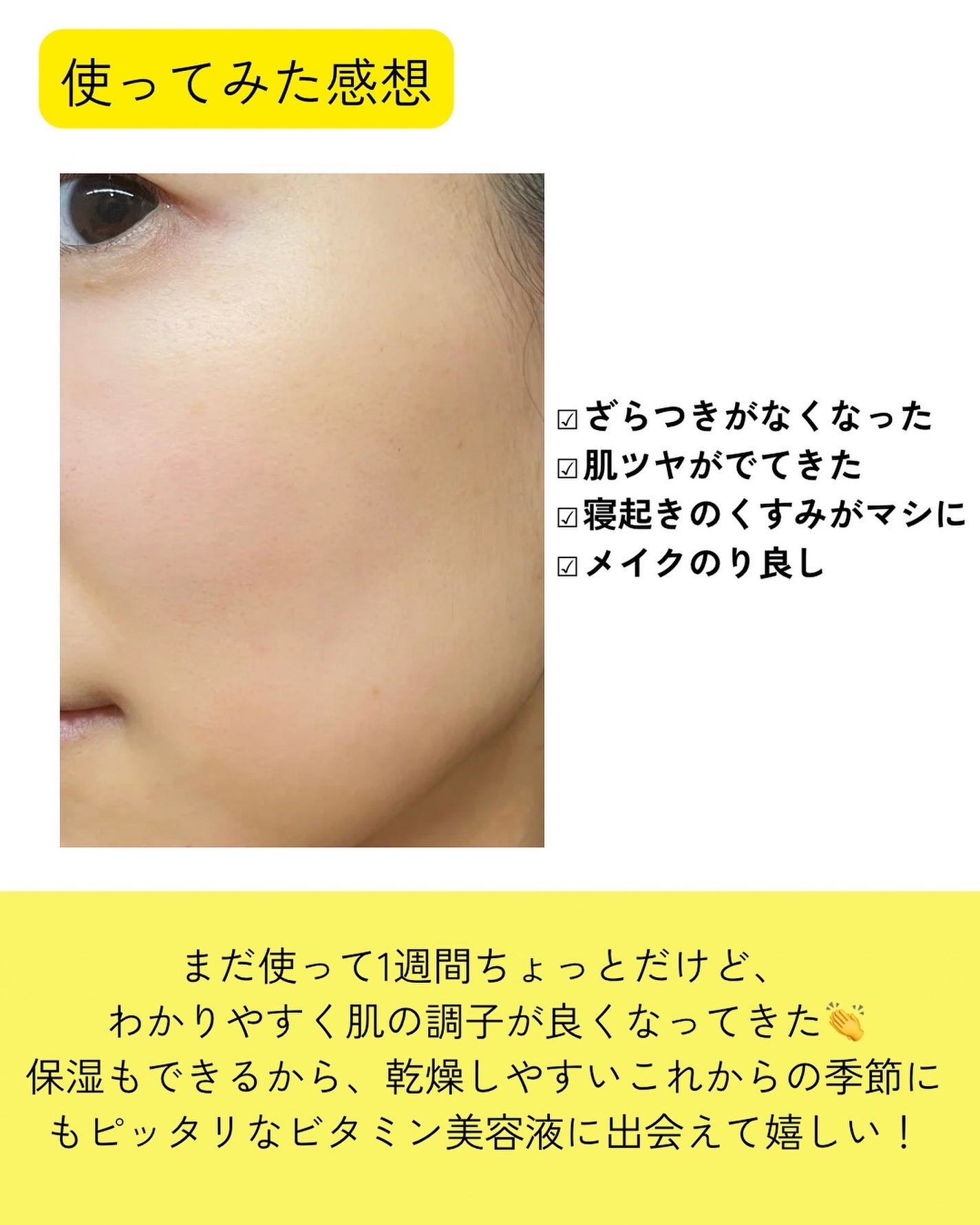 ビタプル ディープリペア セラム/VITAPURU/美容液を使ったクチコミ(8枚目)