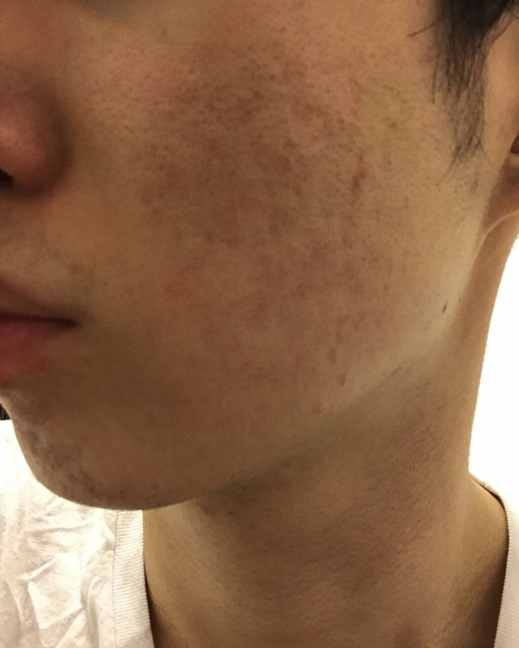 ロゼット 洗顔パスタ ガスールブライト/ロゼット/洗顔フォームを使ったクチコミ（2枚目）