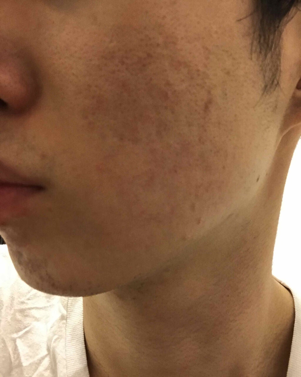 ロゼット 洗顔パスタ ガスールブライト/ロゼット/洗顔フォームを使ったクチコミ(2枚目)