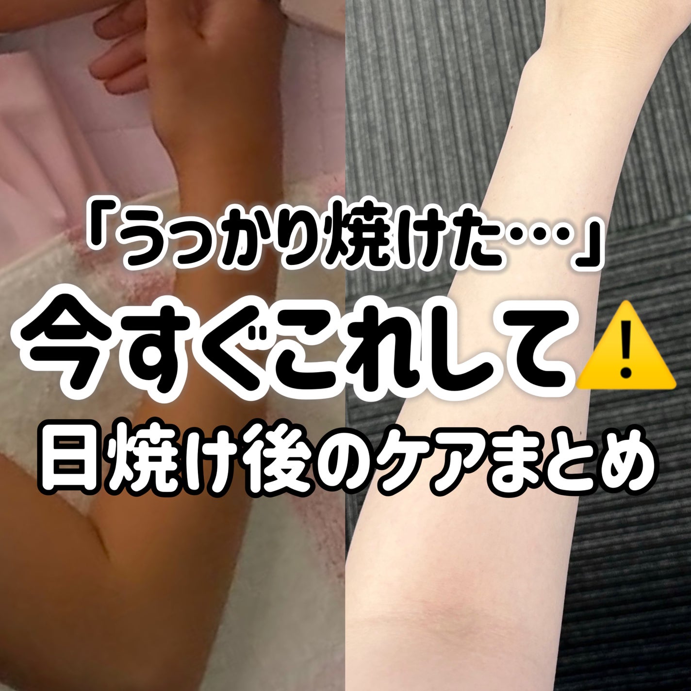 DHC ビタミンCハードカプセル/DHC/美容サプリメントを使ったクチコミ(1枚目)