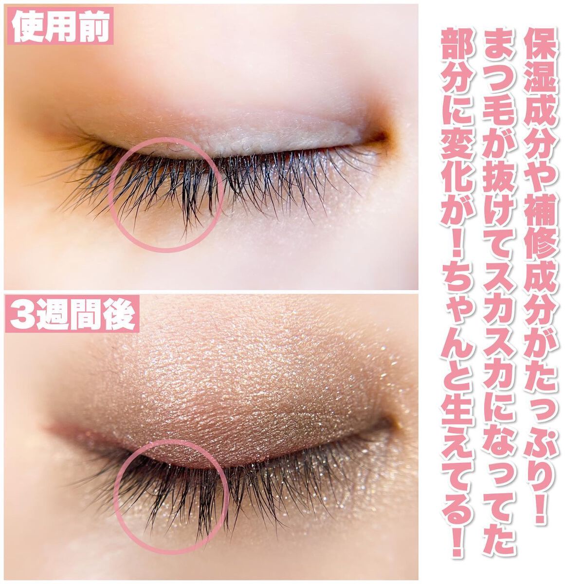 Riho | 集英社MAQUIAエキスパート on LIPS 「2wayブラシが使いやすい‼️目元の印象がUPするまつ毛美容液..」(5枚目)