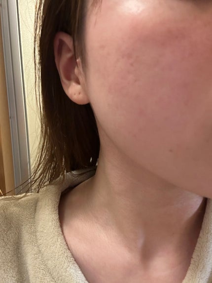 ミルクブライトニングトナー/MEDIHEAL/化粧水を使ったクチコミ(2枚目)