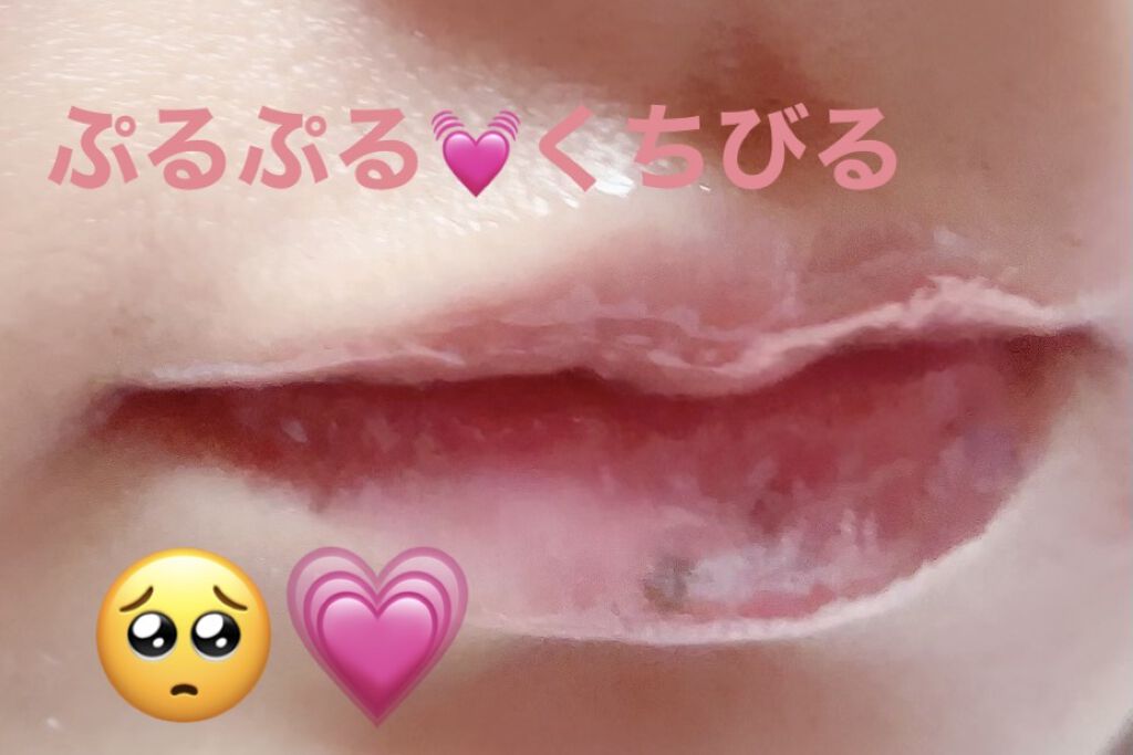 リップパック	/CHOOSY/リップマスクを使ったクチコミ（1枚目）