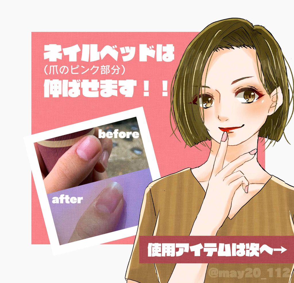 ハンドケアグローブ/エリコネイル/ボディグッズを使ったクチコミ(1枚目)