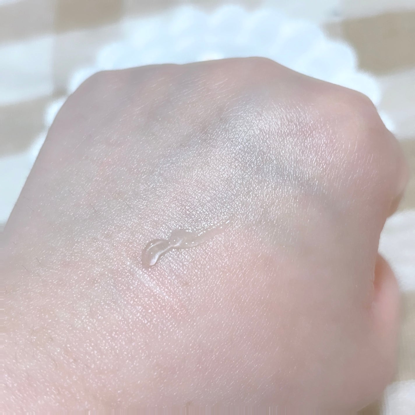 ミラクルクリアスージングスポットジェル/Rael/にきびパッチを使ったクチコミ(6枚目)