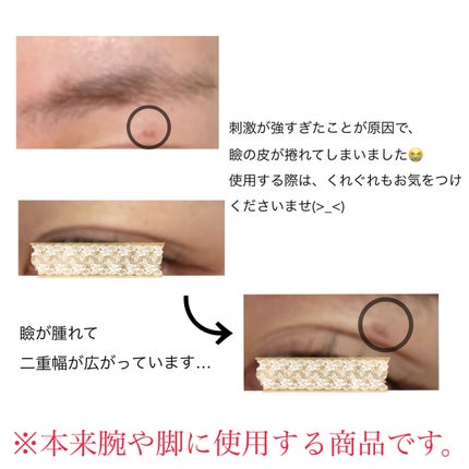 脱色クリーム スピーディー/エピラット/ムダ毛ケアを使ったクチコミ(4枚目)