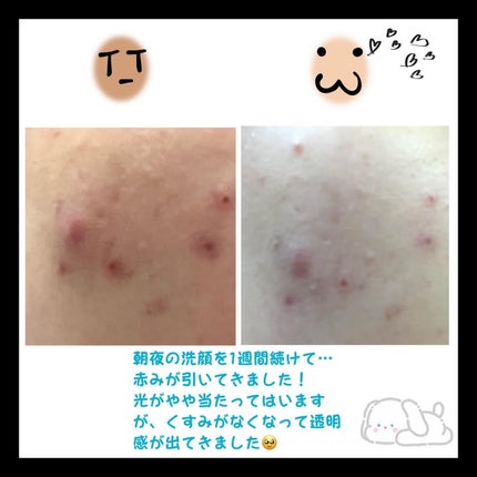 潤浸保湿 泡洗顔料/キュレル/泡洗顔を使ったクチコミ(2枚目)