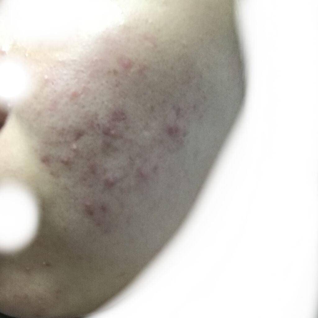 ロゼット 洗顔パスタ 白泥リフト/ロゼット/洗顔フォームを使ったクチコミ（2枚目）