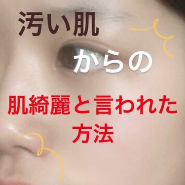 こんにちは！！にこです！🌻
いやーもー花粉が！うん！花粉がヤバすぎる🤧
目も鼻も両方やられながら学校行ってます笑

そんなことはいいとして、、みなさん！！！
肌の調子はどうですか？？？

なんか自慢して