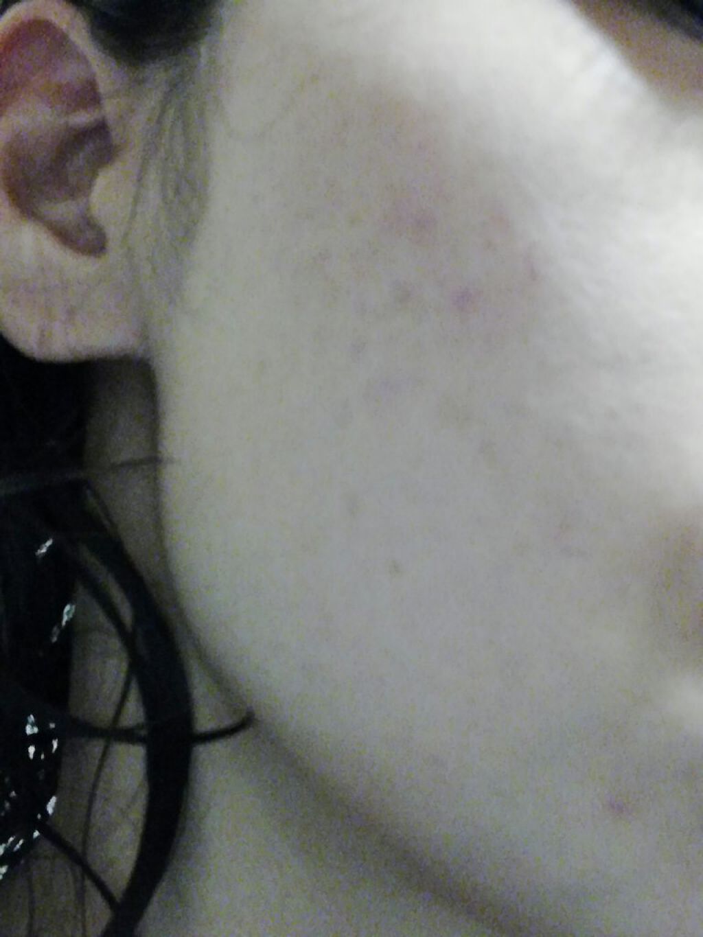 シーバムコントロールVCローションII/プリモディーネ/化粧水を使ったクチコミ（2枚目）