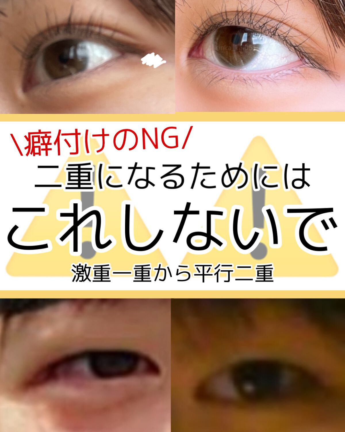 ワンダーアイリッドテープ Extra/D-UP/二重まぶた用アイテムを使ったクチコミ（1枚目）